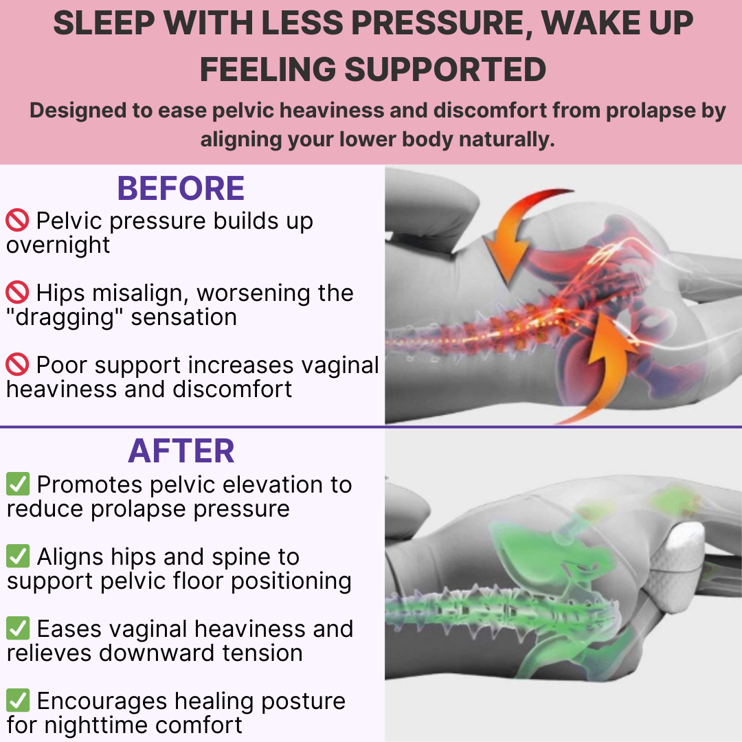 Prolapse Pressure Relief Pillow